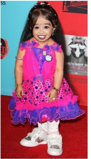 Jyoti Amge